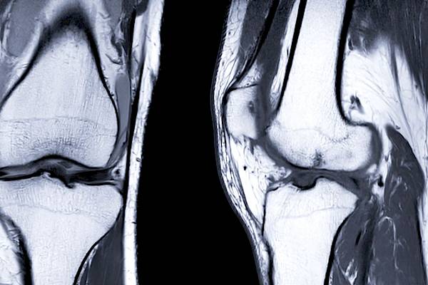 Der Kniespezialist In G Ttingen Arthroveris