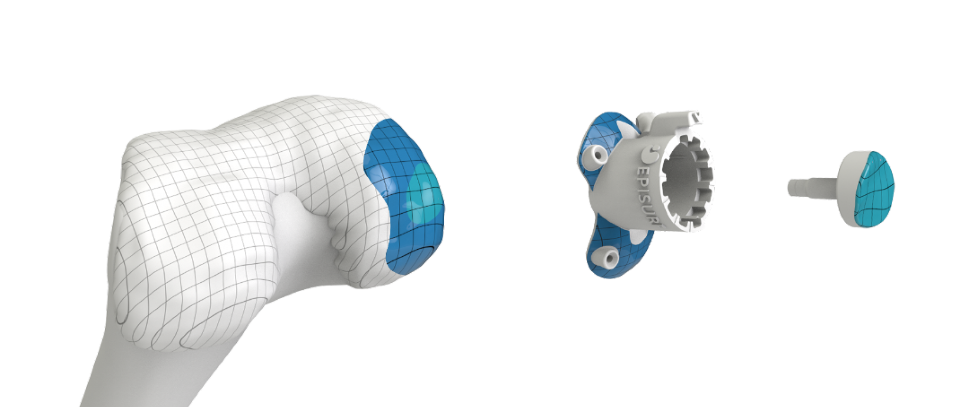 Schaubild eines Miniimplantats für das Knie